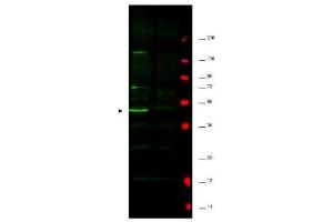 Western blot using  affinity purified anti-Fbp5A antibody shows detection of a major band corresponding to Fbp5A protein in a human HeLa whole cell lysate (lane 1 arrowhead). (Fbp5A anticorps)