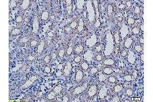 Formalin-fixed and paraffin embedded rat kidney labeled with Anti-AQP5 Polyclonal Antibody, Unconjugated (ABIN731258) followed by conjugation to the secondary antibody and DAB staining (Aquaporin 5 anticorps  (AA 201-265))