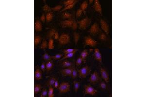 Immunofluorescence analysis of C6 cells using NOB1 antibody (ABIN7270109) at dilution of 1:100. (NOB1 anticorps  (AA 1-230))