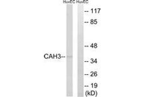 Western Blotting (WB) image for anti-Carbonic Anhydrase III (CA3) (AA 141-190) antibody (ABIN2890188) (CA3 anticorps  (AA 141-190))