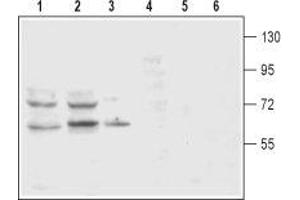 Western blot analysis of rat (lanes 1 and 4) and mouse (lanes 2 and 5) brain membranes and rat pheochromocytoma PC12 (lanes 3 and 6) cell lysates: - 1-3. (SLC6A3 anticorps  (2nd Extracellular Loop))