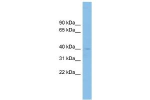WB Suggested Anti-RFFL Antibody Titration: 0. (RFFL anticorps  (Middle Region))