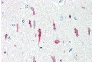 anti-Prion Protein (PRNP) antibody