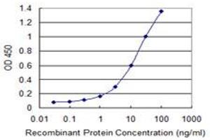 anti-Bone Morphogenetic Protein 5 (BMP5) (AA 323-422) antibody