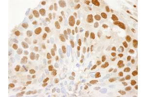 Immunohistochemistry (IHC) image for anti-Exportin 1 (XPO1) (C-Term) antibody (ABIN7448488)
