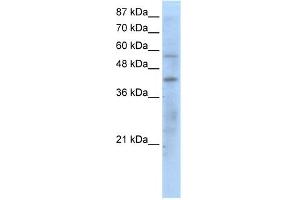 WB Suggested Anti-PPARG Antibody Titration:  1. (PPARG anticorps  (N-Term))