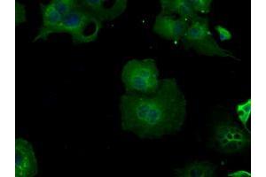 Immunofluorescence (IF) image for anti-Betaine--Homocysteine S-Methyltransferase (BHMT) antibody (ABIN1496916)
