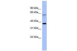 MAGEB1 antibody used at 1 ug/ml to detect target protein. (MAGEB1 anticorps  (Middle Region))