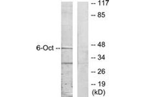 Western blot analysis of extracts from A549 cells, using OCT6 Antibody. (POU3F1 anticorps  (AA 311-360))