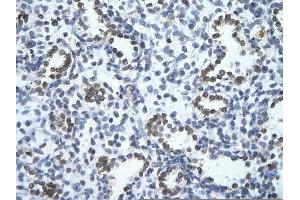 Rabbit Anti-PHF17 Antibody       Paraffin Embedded Tissue:  Human alveolar cell   Cellular Data:  Epithelial cells of renal tubule  Antibody Concentration:   4. (PHF17 anticorps  (C-Term))