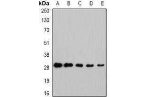 Western blot analysis of NNMT expression in Hela (A), HepG2 (B), mouse brain (C), rat lung (D), rat liver (E) whole cell lysates.