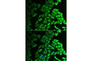 Immunofluorescence analysis of A549 cells using IL18BP antibody. (IL18BP anticorps  (AA 31-194))