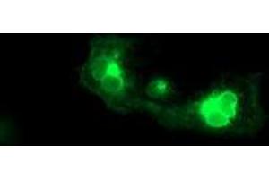 Anti-FGFR2 mouse monoclonal antibody (ABIN2454751) immunofluorescent staining of COS7 cells transiently transfected by pCMV6-ENTRY FGFR2 (RC217098). (FGFR2 anticorps)