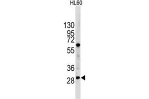 Western Blotting (WB) image for anti-Lin-28 Homolog B (LIN28B) antibody (ABIN2998297) (LIN28B anticorps)