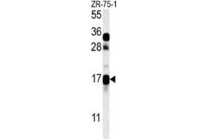 Western Blotting (WB) image for anti-CSAG Family, Member 2 (CSAG2) antibody (ABIN3002341) (CSAG2 anticorps)