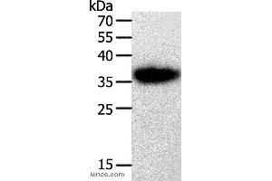 Western blot analysis of A549 cell, using PLAUR Polyclonal Antibody at dilution of 1:450 (PLAUR anticorps)