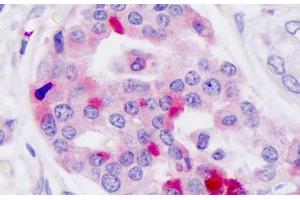 Anti-GLP-1 Receptor / GLP1R antibody IHC staining of human pancreas, islet of langerhans. (GLP1R anticorps  (N-Term))