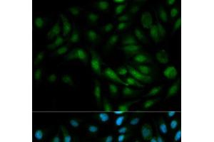 Immunofluorescence analysis of MCF-7 cells using MAPK7 Polyclonal Antibody (MAPK7 anticorps)