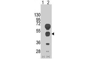 Western blot analysis of GATA4 (arrow) using rabbit GATA4 polyclonal antibody . (GATA4 anticorps  (C-Term))