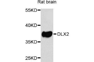 Western blot analysis of extracts of rat brain cells, using DLX2 antibody. (DLX2 anticorps)