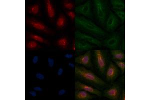 ABIN6259171 and ABIN6275708 staining  cells by IF/ICC. (RAD51C anticorps  (Internal Region))
