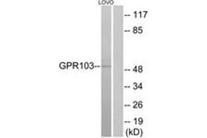 Western blot analysis of extracts from LOVO cells, using GPR103 Antibody. (QRFPR anticorps  (AA 271-320))