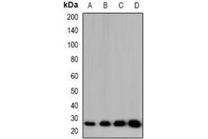 Western blot analysis of CIDEB expression in HT29 (A), RAW264. (CIDEB anticorps)
