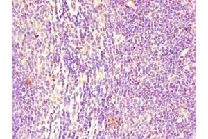 Immunohistochemistry of paraffin-embedded human lymph node tissue using ABIN7158541 at dilution of 1:100 (FCGR2B anticorps  (AA 12-289))