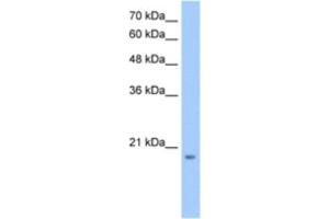 anti-MGC4172 antibody