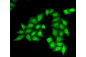 Immunofluorescence analysis of HeLa cells using SSRP1 antibody (ABIN6129536, ABIN6148492, ABIN6148494 and ABIN6217711). (SSRP1 anticorps  (AA 1-300))