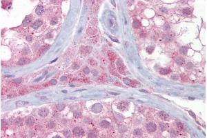 Immunohistochemistry with Testis tissue at an antibody concentration of 5µg/ml using anti-UBE2L3 antibody (ARP43023_P050) (UBE2L3 anticorps  (Middle Region))