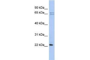 WB Suggested Anti-RPL18 Antibody Titration: 0. (RPL18 anticorps  (N-Term))