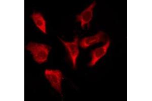 ABIN6276234 staining HT29 by IF/ICC.