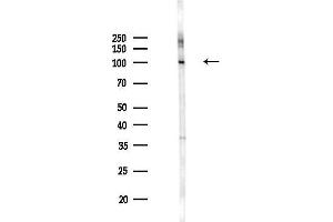 Western blot analysis of lysates from Mouse liver, using hnRNP U Antibody at 1/1000 dilution.