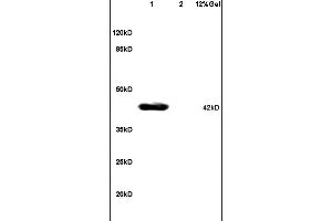 L1 mouse brain lysates L2 human colon carcinoma lysates probed with Anti - phospho-JNK1/2/3 (Thr183+Thr185) Polyclonal Antibody, Unconjugated at 1:200 in 4 ˚C.