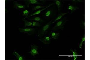 Immunofluorescence of purified MaxPab antibody to FOSL2 on HeLa cell. (FOSL2 anticorps  (AA 1-326))