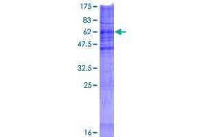 Image no. 1 for Choline Phosphotransferase 1 (CHPT1) (AA 1-406) protein (GST tag) (ABIN1349378)