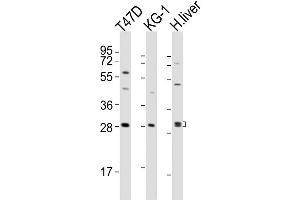 Western Blot at 1:2000 dilution Lane 1: T47D whole cell lysates Lane 2: KG-1 whole cell lysates Lane 3: human liver lysates Lysates/proteins at 20 ug per lane.