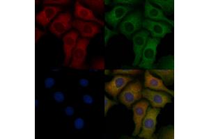 ABIN6258288 and ABIN6275675 staining Hela cells by IF/ICC. (NSF anticorps  (Internal Region))