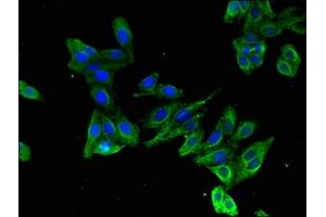 Immunofluorescent analysis of HepG2 cells using ABIN7157694 at dilution of 1:100 and Alexa Fluor 488-congugated AffiniPure Goat Anti-Rabbit IgG(H+L)