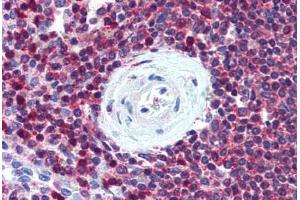 Human Spleen (formalin-fixed, paraffin-embedded) stained with SLC9A3R1 antibody ABIN305897 at 5 ug/ml followed by biotinylated goat anti-rabbit IgG secondary antibody ABIN481713, alkaline phosphatase-streptavidin and chromogen. (SLC9A3R1 anticorps)