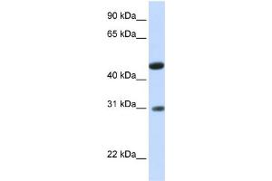 WB Suggested Anti-LOC388323 Antibody Titration:  0. (GLTPD2 anticorps  (N-Term))