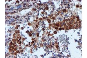 Image no. 3 for anti-NADH Dehydrogenase (Ubiquinone) 1 beta Subcomplex, 9, 22kDa (NDUFB9) (AA 3-179) antibody (ABIN1491359)