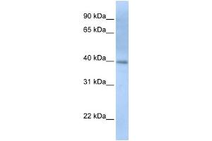 WB Suggested Anti-ITPK1 Antibody Titration: 0. (ITPK1 anticorps  (N-Term))