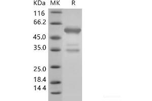 Western Blotting (WB) image for High Mobility Group Box 1 (HMGB1) (Active) protein (Fc Tag) (ABIN7196094)