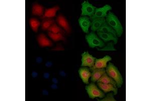 ABIN6254880 and ABIN6268792 staining Hela cells by IF/ICC.