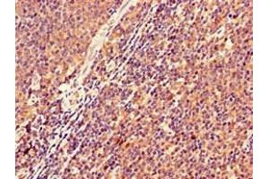 Immunohistochemistry of paraffin-embedded human lymph node tissue using ABIN7157511 at dilution of 1:100 (KIR2DS2 anticorps  (AA 104-241))