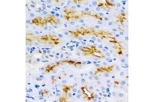 Immunohistochemical analysis of BMP15 staining in rat kidney formalin fixed paraffin embedded tissue section. (BMP15 anticorps)