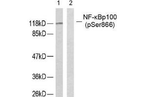 Western blot analysis of extracts from ovary cancer cells using NF-κ,B p100 (phospho-Ser866) antibody.