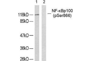 Western blot analysis of extracts from ovary cancer cells using NF-κ,B p100 (phospho-Ser866) antibody. (NFKB2 anticorps  (pSer866))